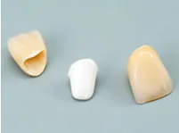 口腔内に装着されたジルコニアのクラウン。周囲の歯と調和した自然な白い歯。